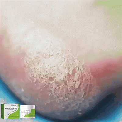 South Moon - 42% Urea Cream