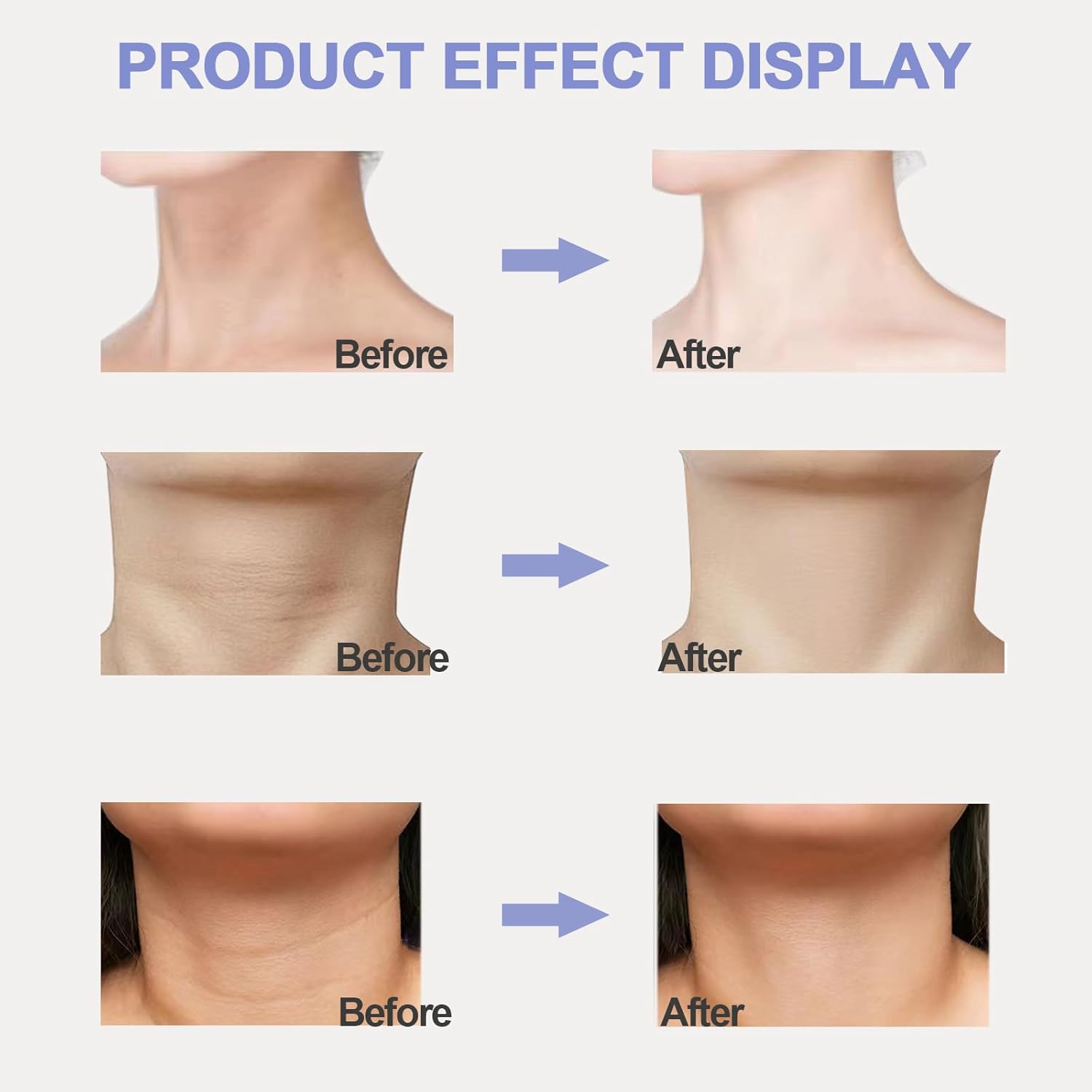 Tighten & Lift Neck Cream ℗